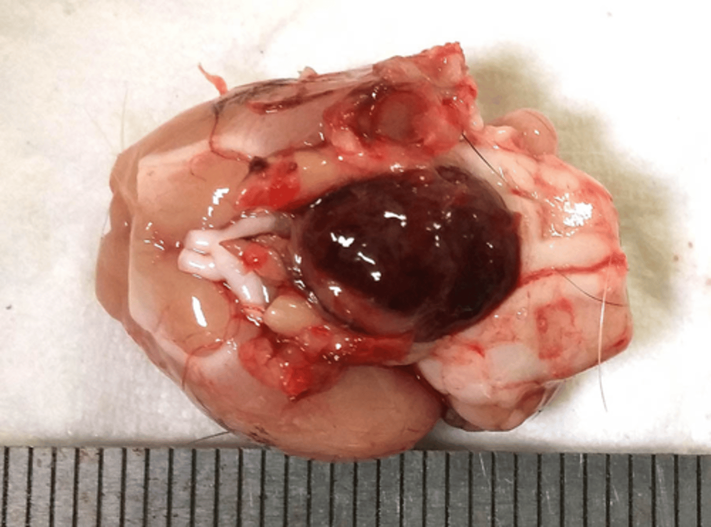 <p>An extremely common tumor of rats that is more common in female rats; benign and slow growing; factors include age, genetic factors, diet, breeding history, infections, injury</p>