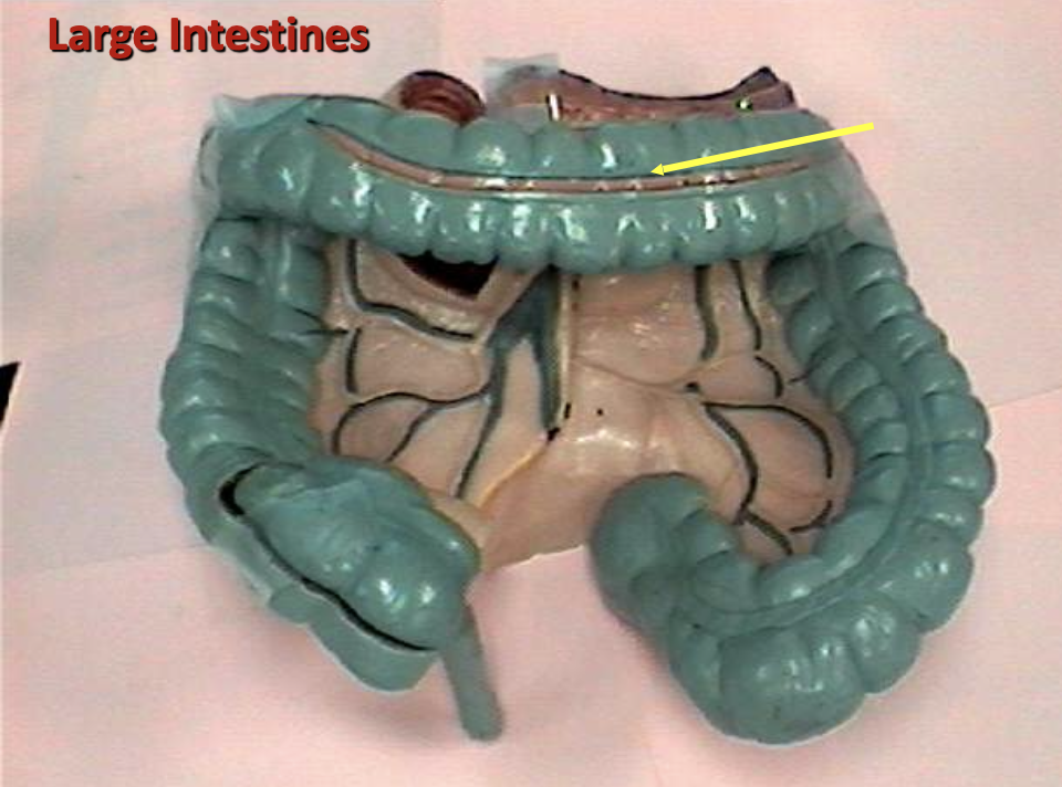 <p>Identify the organ.</p>