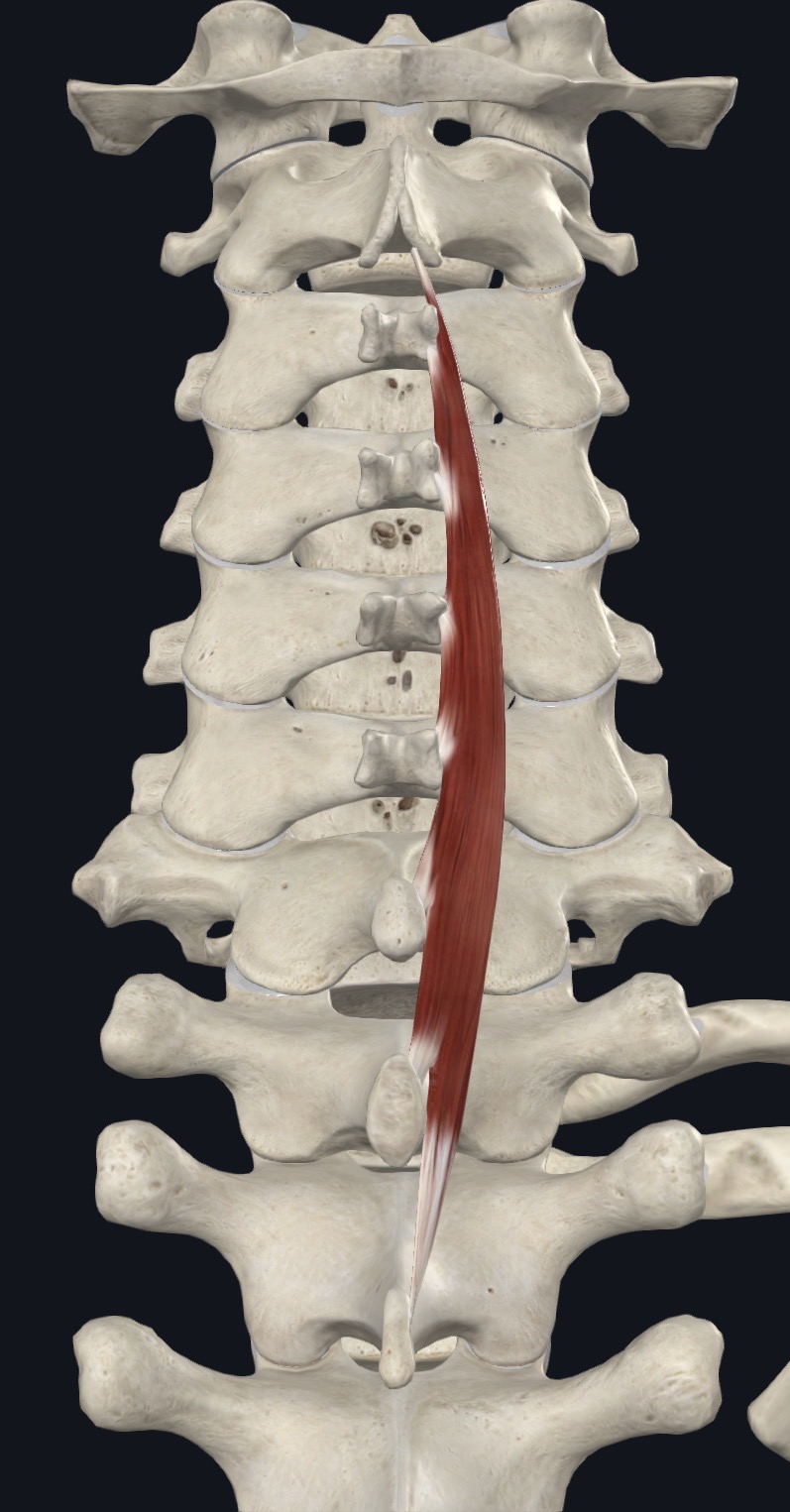 <p><strong>Unilateral:</strong> Ipsilateral lateral flexion</p><p><strong>Bilateral:</strong> extension</p>