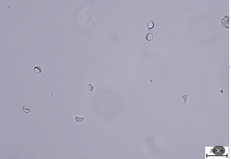 <p>giardia duodenalis (or intestinalis), G.canis </p><p>Carnivores. </p><p>cyst - oval shape, 4 nuclei, fragments of medial bodies, decomposed suction disk, transparent color. </p><p>Flotation - Faust solution. </p>