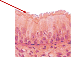 <p>Name this structure</p>