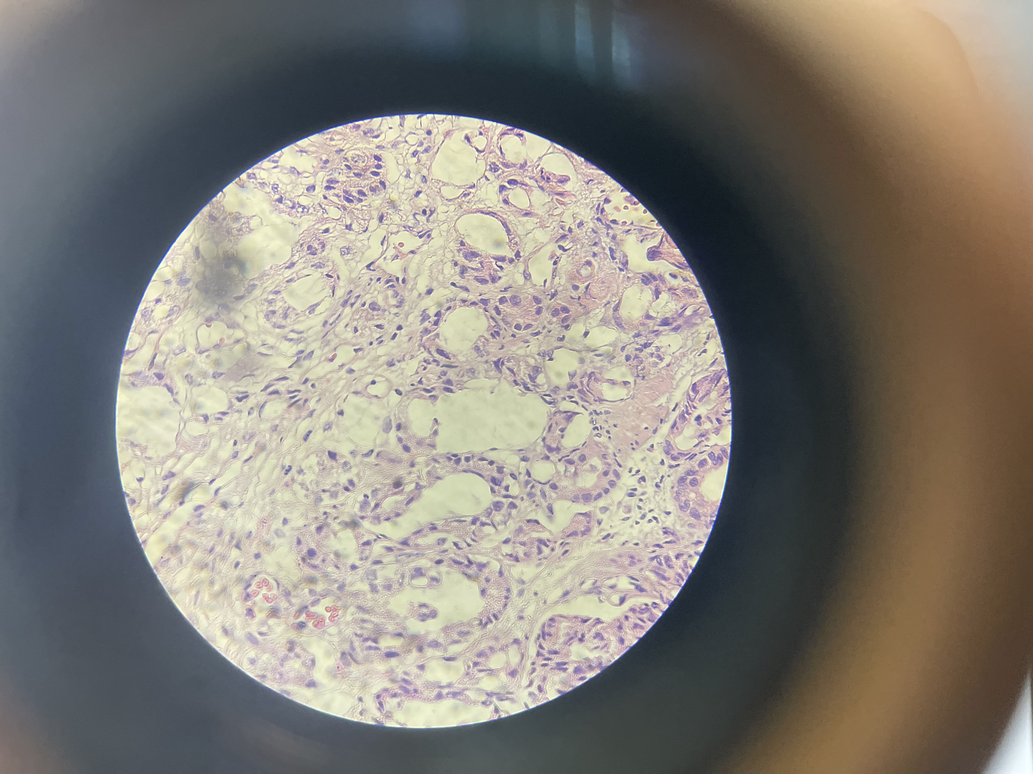 <p>What is the diagnosis?</p>