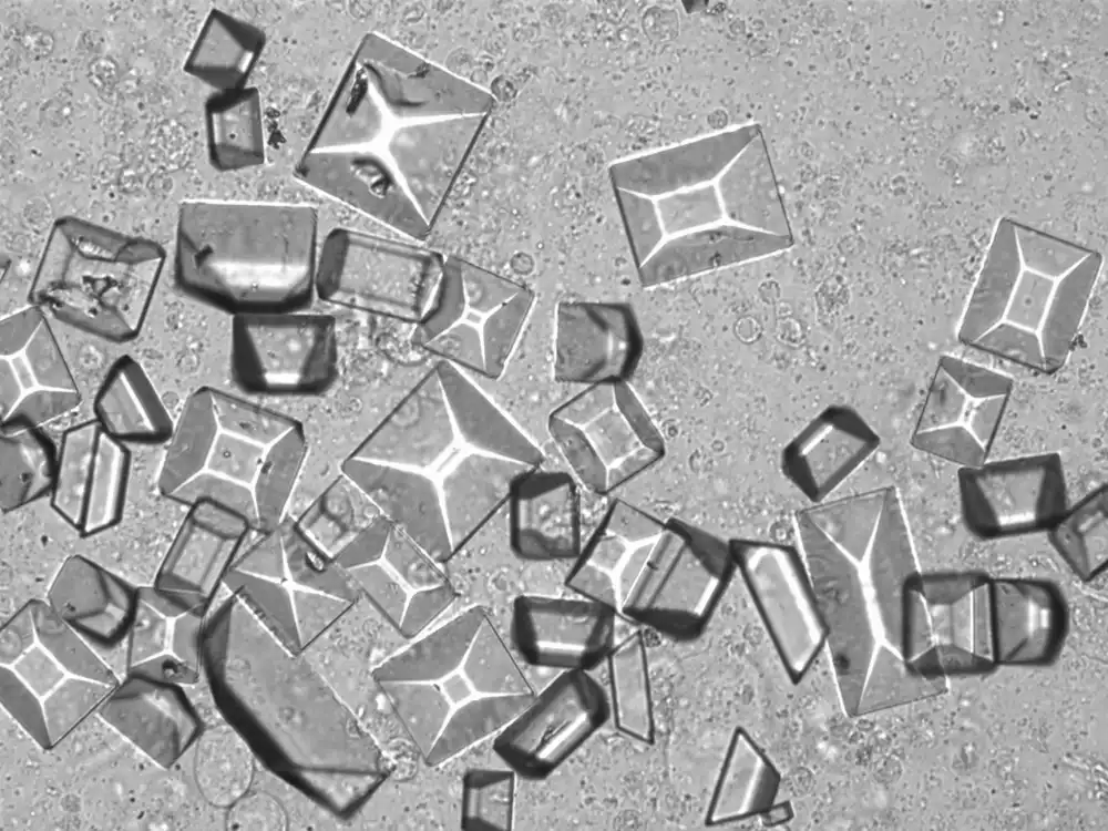 <p>Triple phosphate crystal</p>