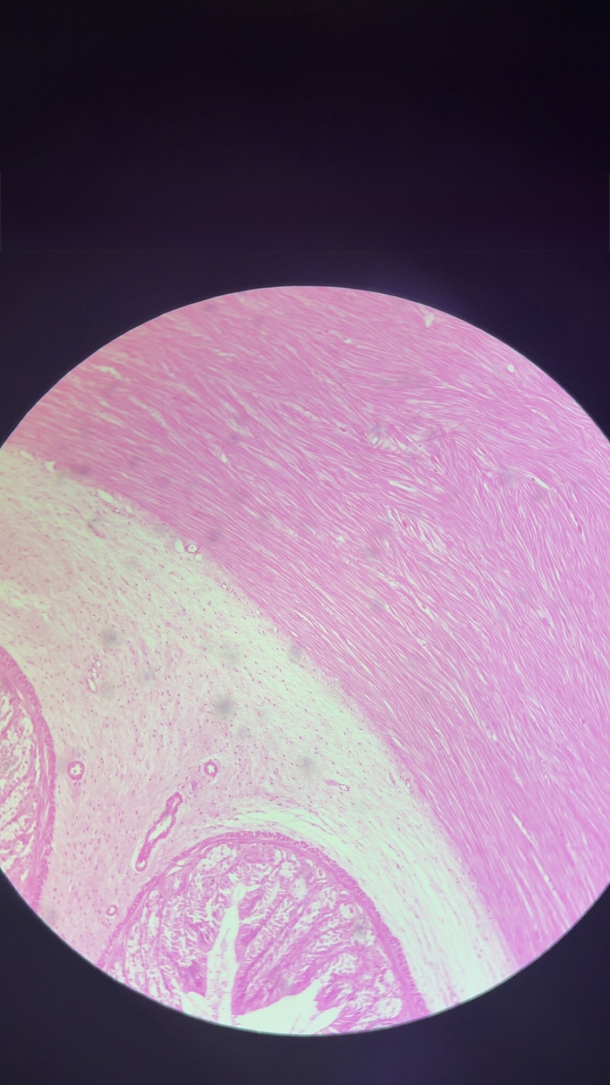 <p>what kind of muscle </p>