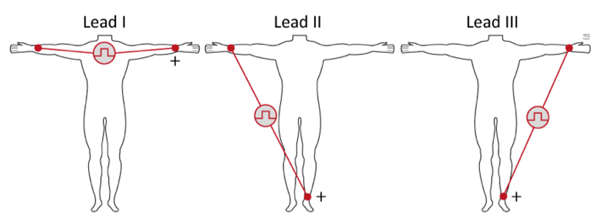 <p>Lead III</p>
