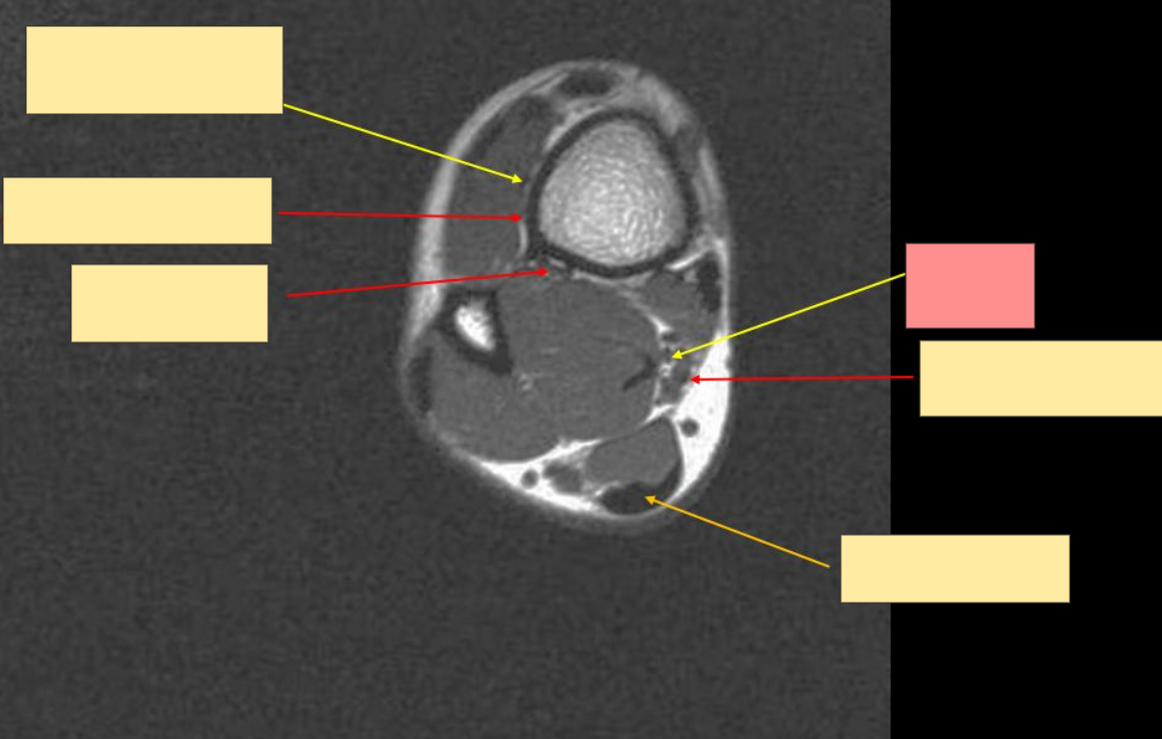 <p>Identify this structure</p>