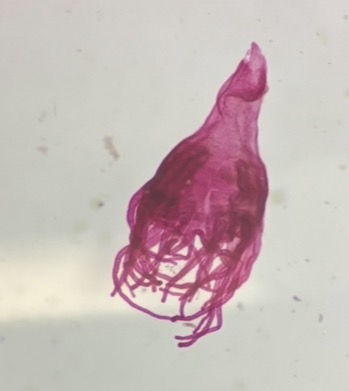 <p>What phylum and class is this? Also what life stage?</p>
