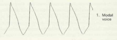 <p>Voice quality produced with extremely high longitudinal tension, high F0, and very thin vocal fold contact.</p>