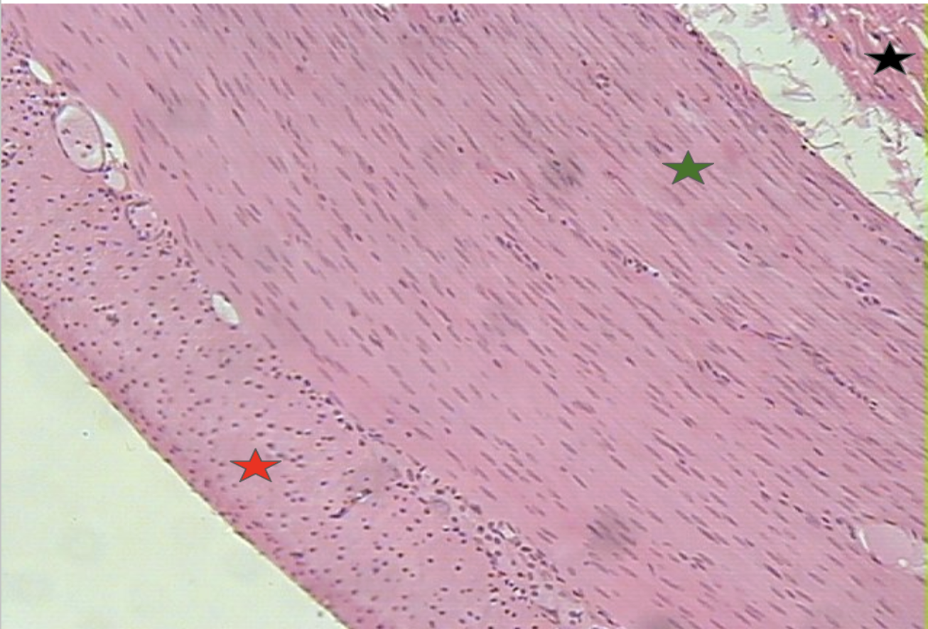 <p>What organ is this? Identify</p>