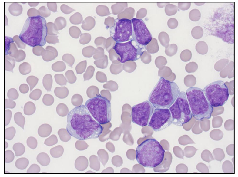 <p>- top left cell</p><p>- somewhere in the middle you can see as well</p>