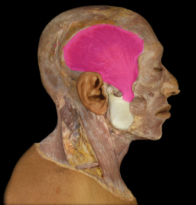 <p>action: elevates mandible (mastication, i.e., chewing)</p>