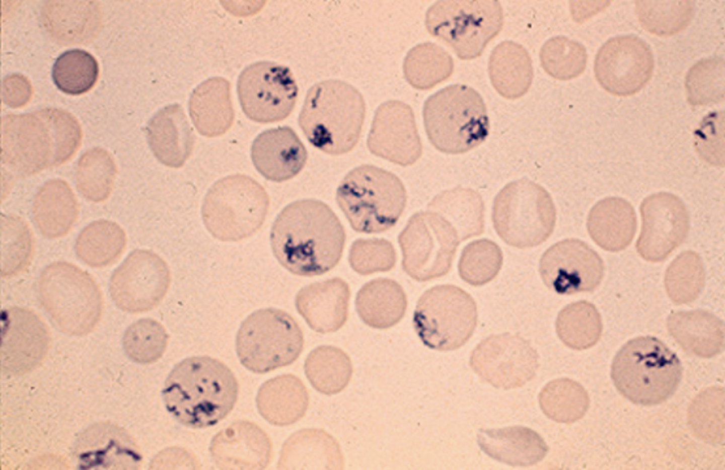 <p>Immature RBCs with retained RNA</p>
