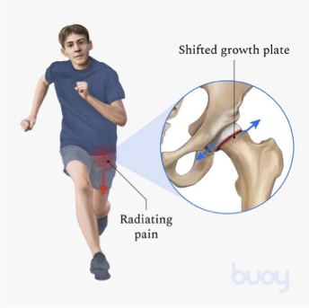 <p>flexion and IR </p>