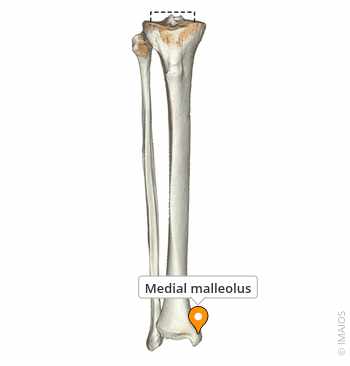 <p>projection on the distal, medial surface; prominent bony landmark at the ankle</p>