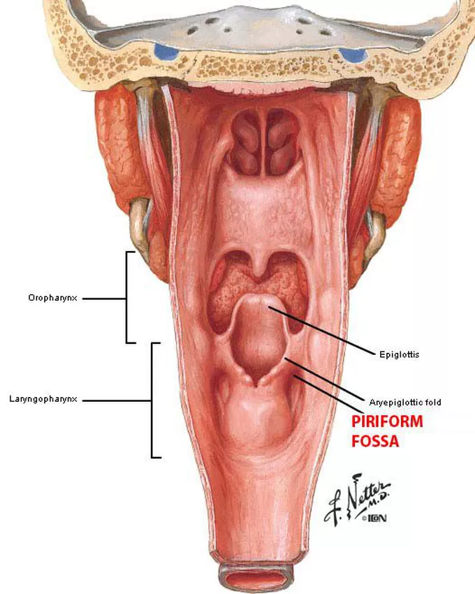 <p>medially by the aryepiglottic fold </p><p>laterally by the thyroid cartilage and thyrohyoid membrane </p>
