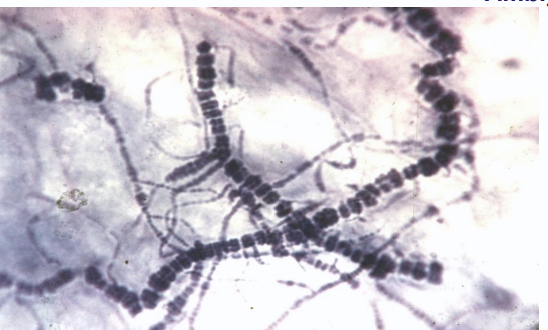 <p>railroad track like appearance  </p>