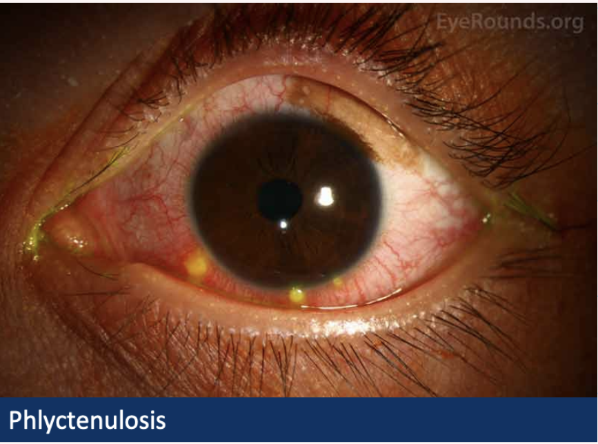 <p>Describe and give diagnosis - good to know</p>