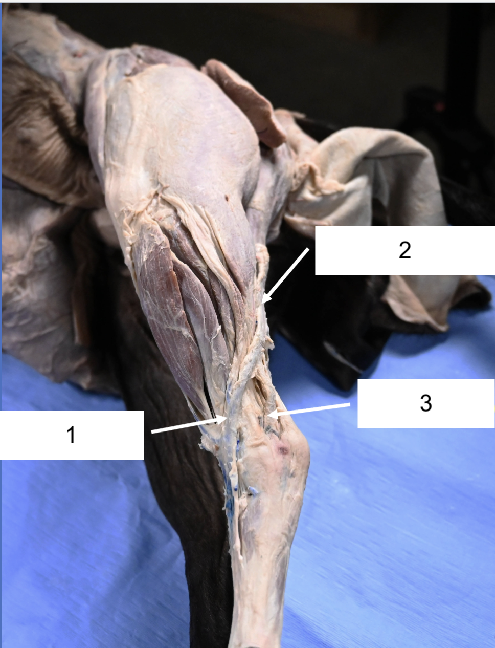 <p>What vein is 1? (be specific)</p>