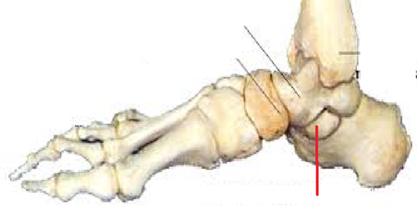 <p>foot - calcaneus</p>