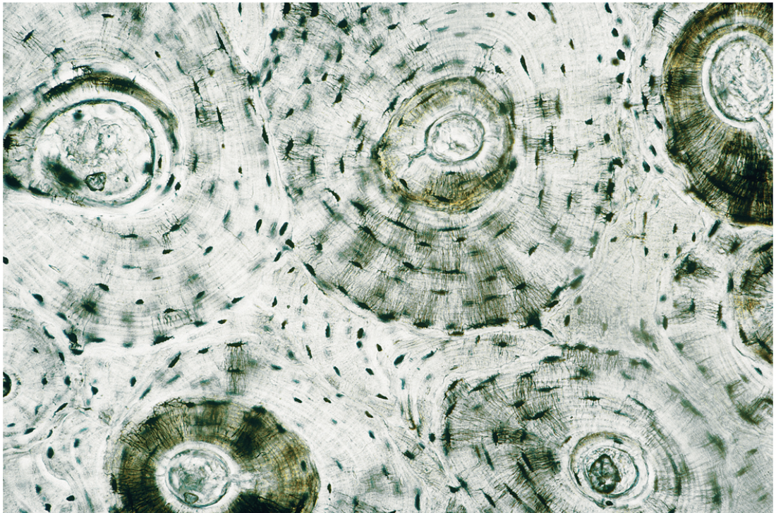 <p>Ring like organization. Osteons are circular structures that look like bullseyes. Concentric lamellae are rings of bone tissue surrounding the center of each osteon. Lacunae are tiny dark spaces between the rings where osteocytes are located. The tissue appears very dense and organized, with little open space</p><p></p>
