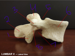 <p>Lumbar Lateral - #3</p>
