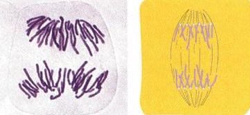 <p>what stage of mitosis is this? what type of cell is this?</p>