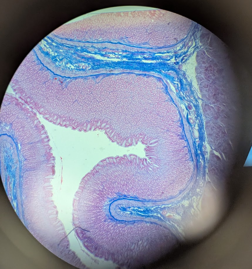 <p>Where in the body is this</p>