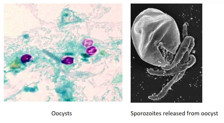 <p>Describe the <strong>Disease Symptoms </strong>of this waterborne protozoan:</p><p>-<strong>Cryptosporidia parvum</strong></p>