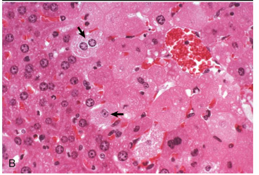 <p>Which side of the image contains normal cells</p>