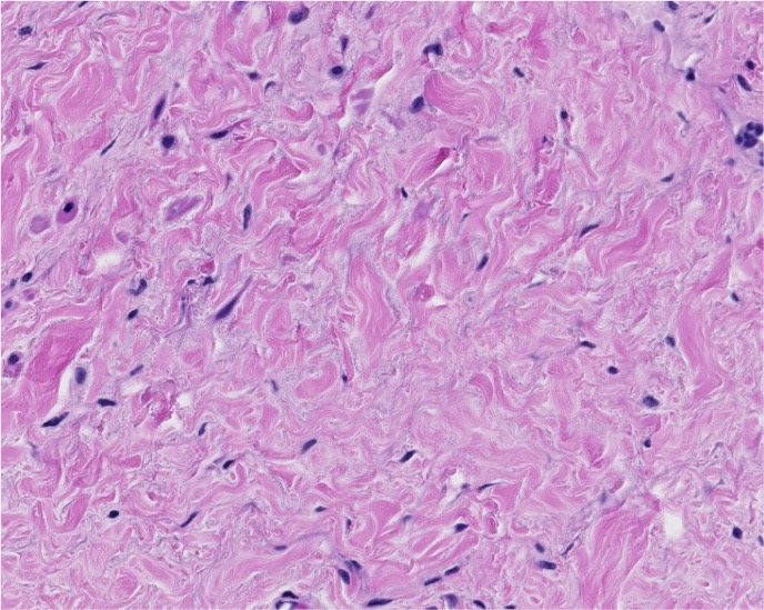 <p><span style="font-family: "Calibri Light";">Which type of CT is this?</span></p>