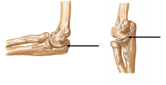 <p>Compound joint comprising the humeroulnar and humeroradial articulations.</p>