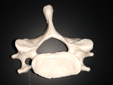 <p>Which vertebrae is this?</p>