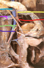 <p>what is the magneta line pointing to?</p>