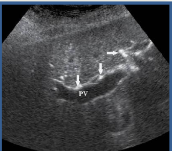 <p>what phase is this</p>