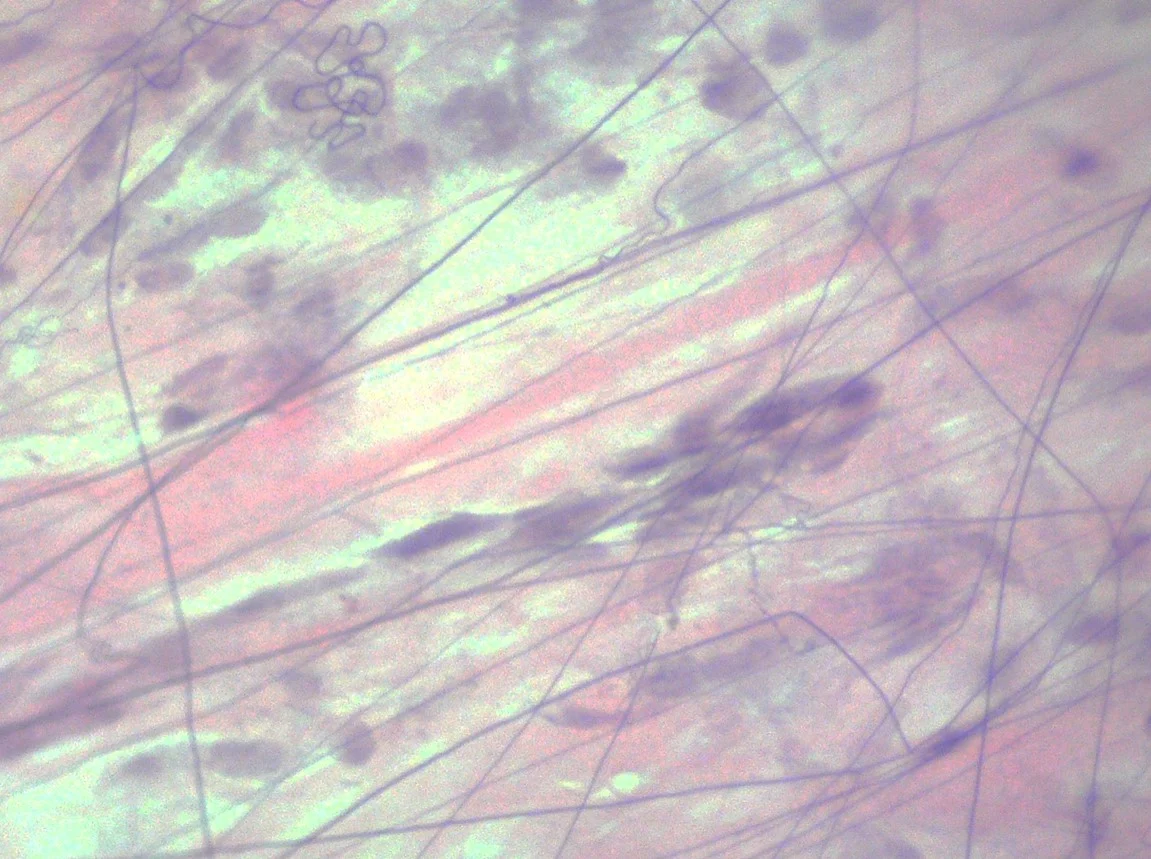 <p><span>Identify the tissue in the micrograph.</span></p>