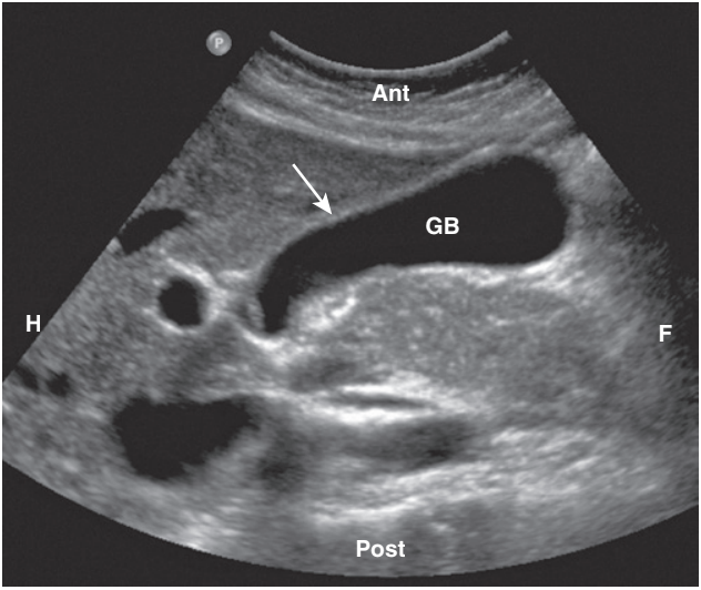 <p>Describe radiograph</p>