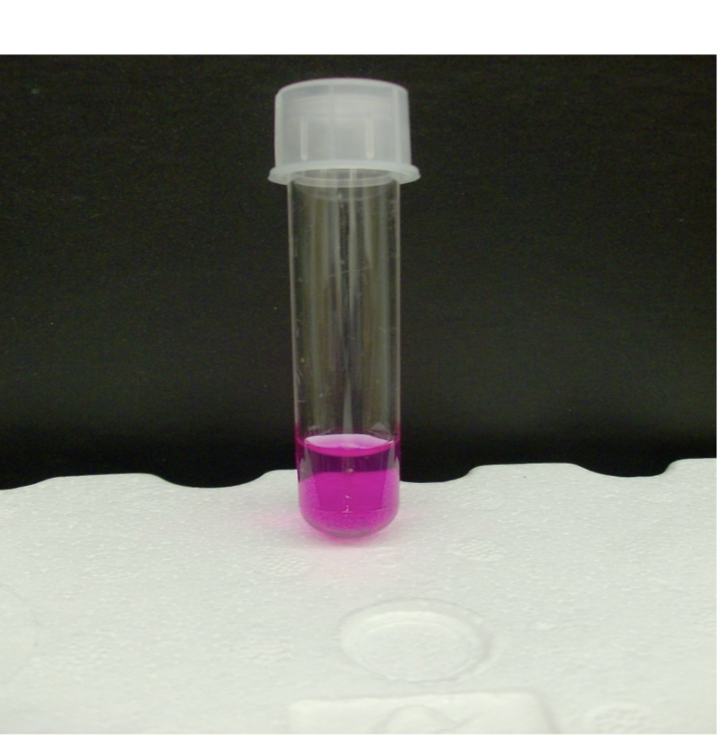 <p>what is the test and result?</p>