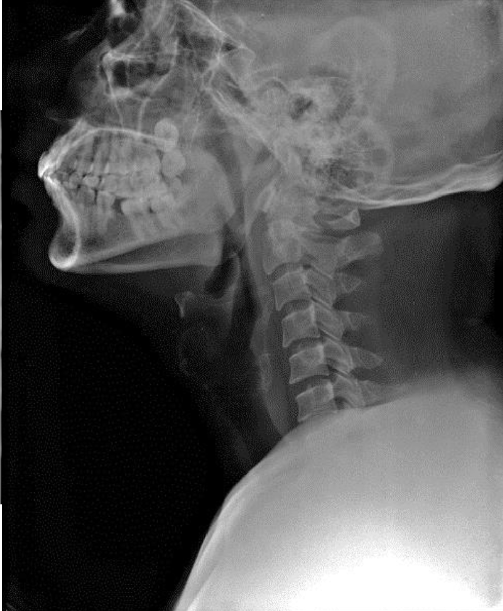 <p>What is the diagnosis?</p>