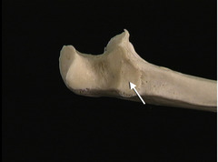 <p>In this lateral view of the right ulna, identify the bony feature indicated by the arrow</p>
