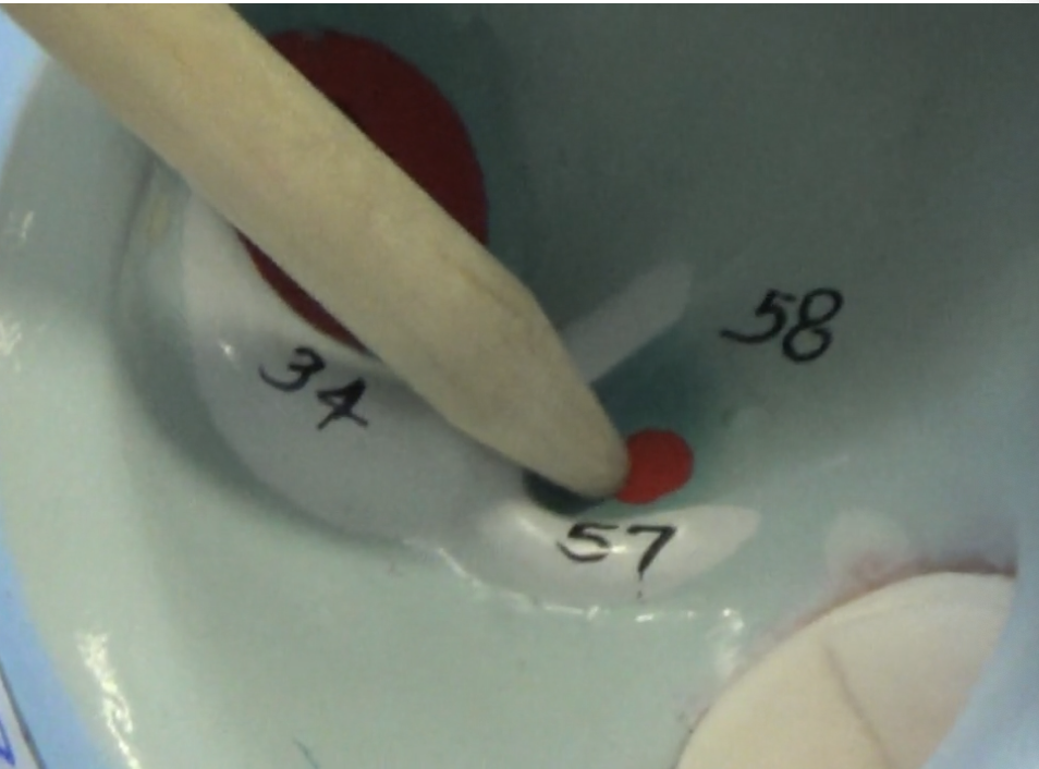 <p>where most of the blood from coronar circulation returns to right atrium</p>