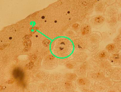 <p>identify the indicated phase of mitosis</p>
