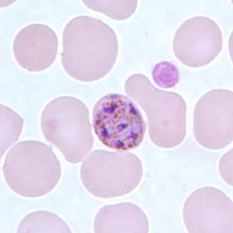 <p>rosette form merozoite in old RBC?</p>
