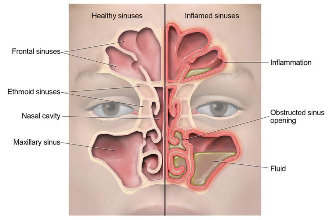 <p>in the maxilla and has a bigger opening</p>