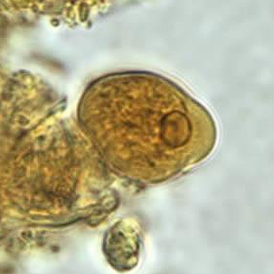 <p>Trophozoite</p><ul><li><p>15-20uM in size, single nucleus</p></li></ul><p>Cyst</p><ul><li><p>Four nuclei</p></li></ul><p></p>