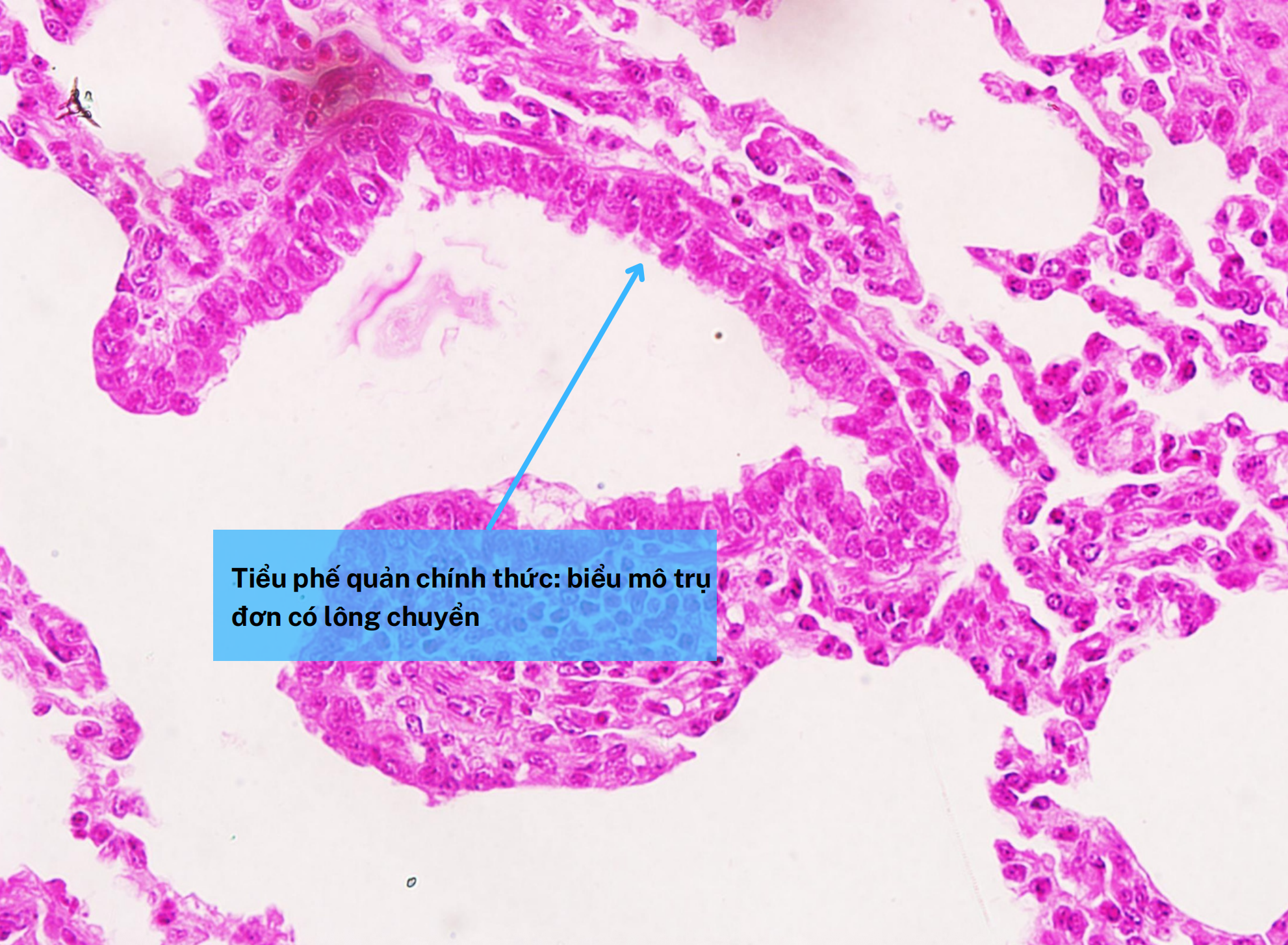 <p>Tiểu phế quản chính thức</p>