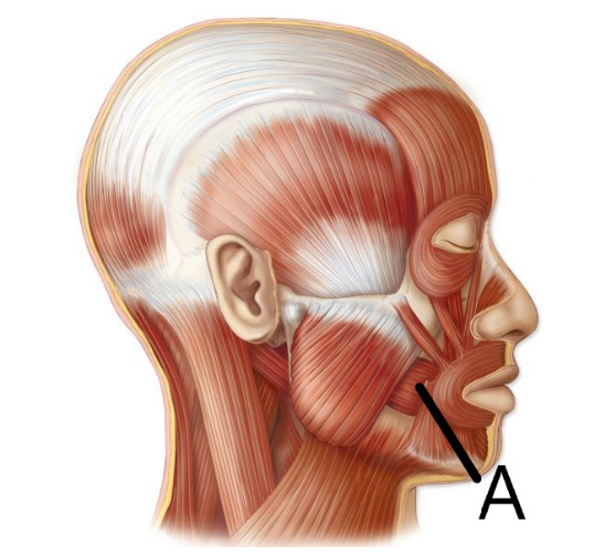 <p>which facial muscle is this</p>