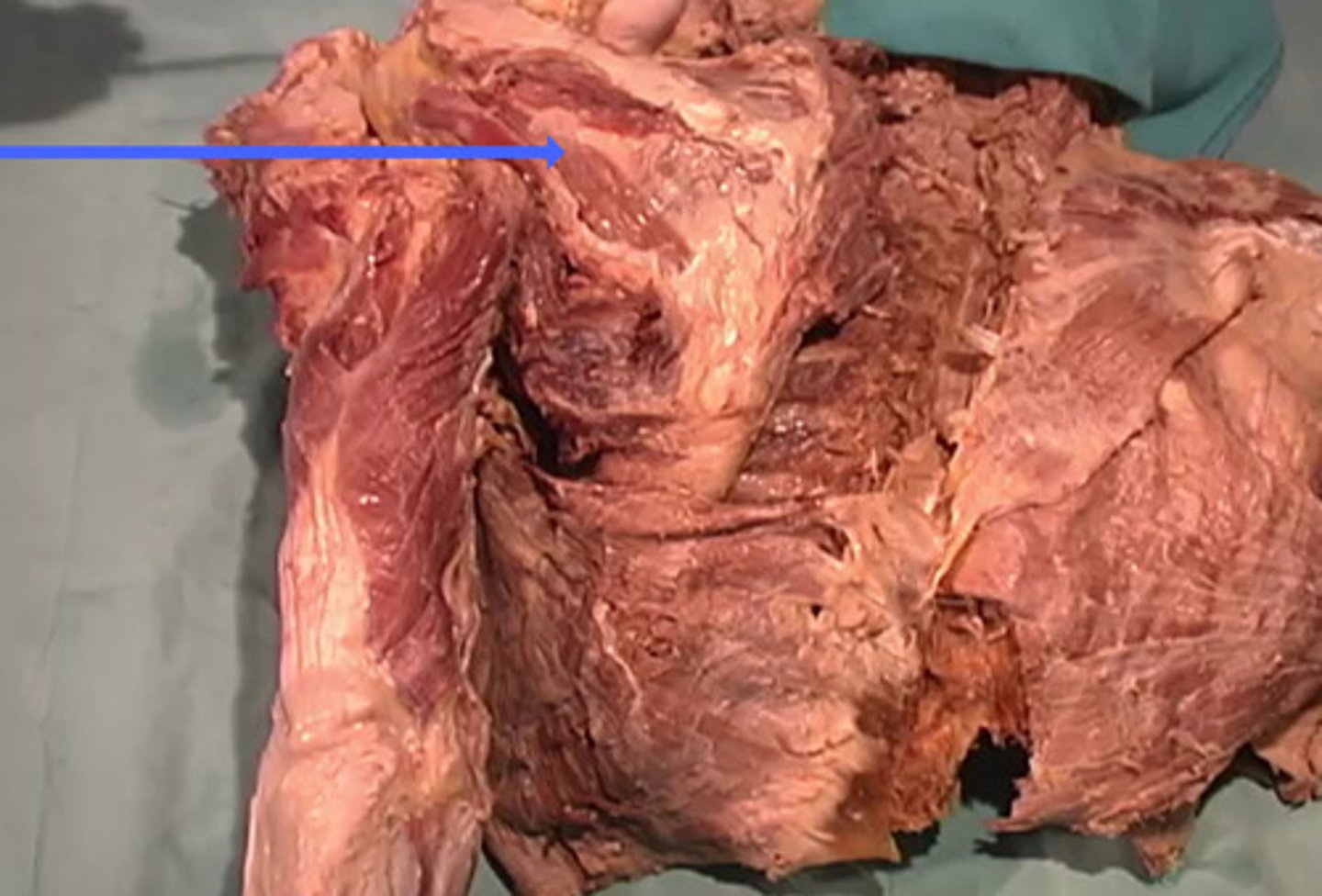 <p>What is the name of this muscle as indicated by the arrow?</p>