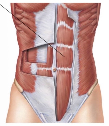 <p>Rectus abdominis actions</p>