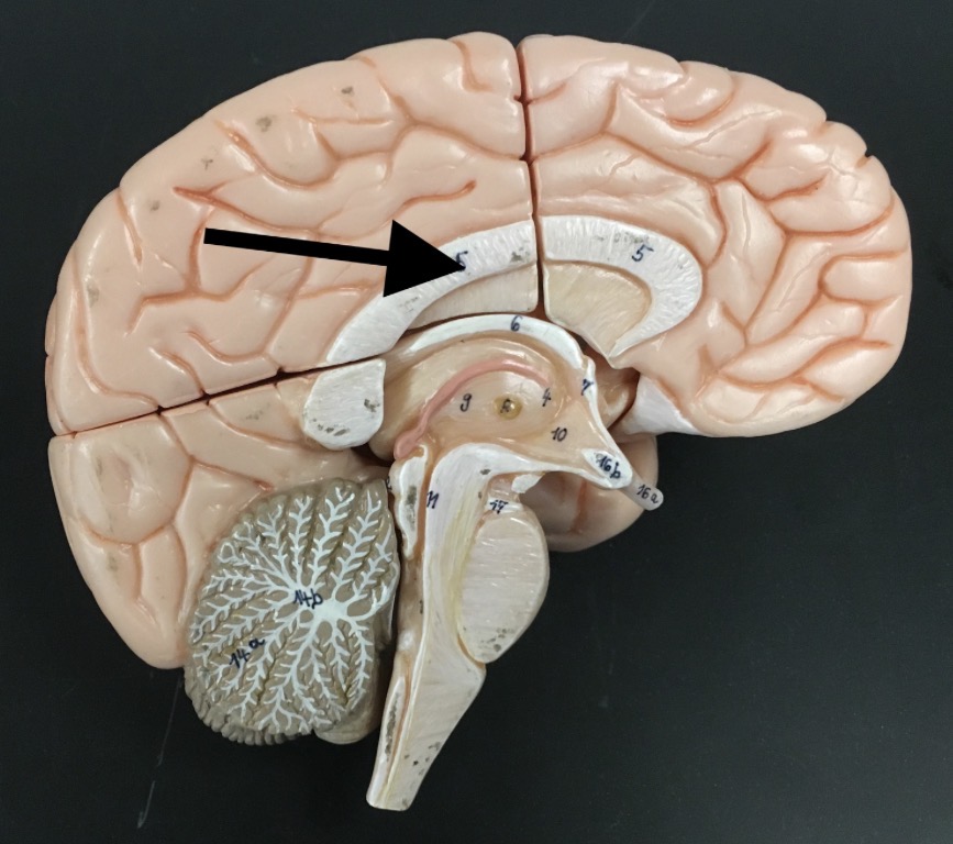 <p>What is the arrow pointing to?</p>