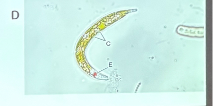 <p>What is this organism?</p>